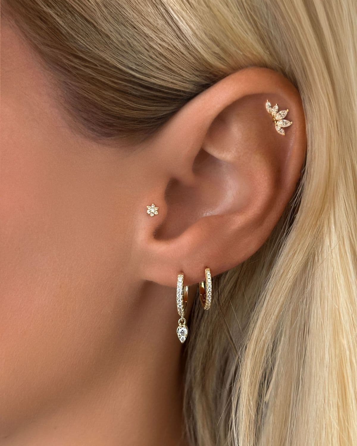 Aretes